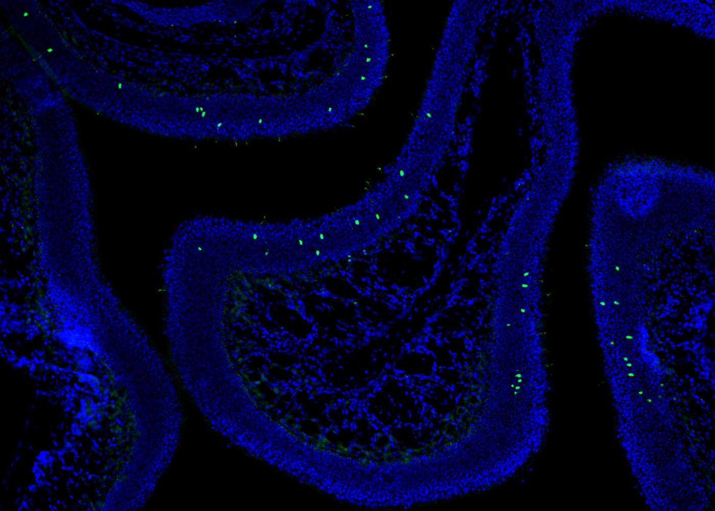 A section of the olfactory epithelium. Cells that express a single specific olfactory receptor gene (Olfr17) are in green and DNA, which labels the nucleus of every cells, is blue. Because of the random choice, cells expressing Olfr17 are scattered throughout the tissue (Credit: Kevin Monahan & Adan Horta/Lomvardas lab/Columbia's Zuckerman Institute).