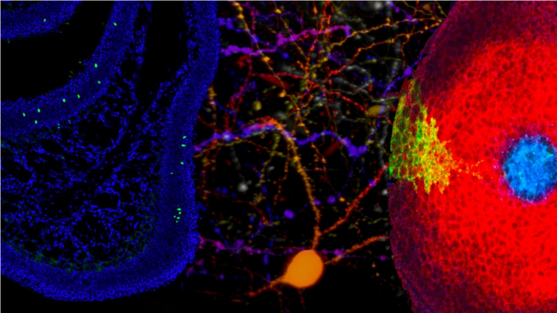  Images of nerve cells created by the labs of Drs. Lomvardas (left), Hillman (center) and Struhl (right).