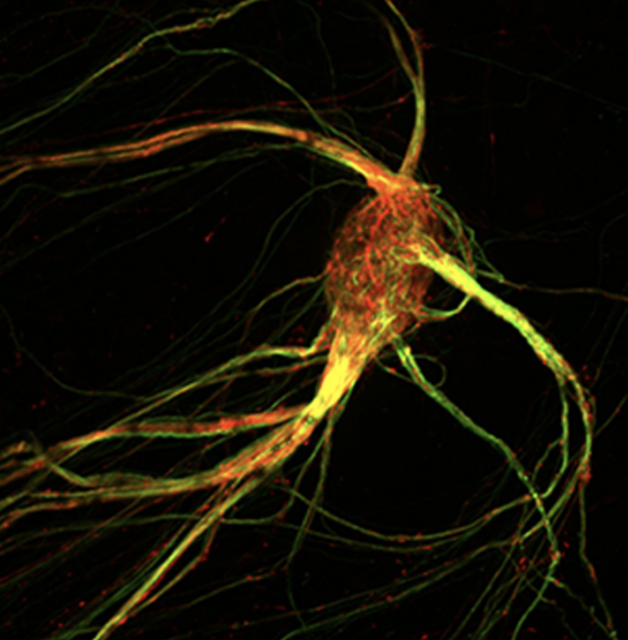 Labeled in red and green in this photo illustration are axons of sensory cells in a single glomerulus within a mouse brain’s olfactory bulb. (Lomvardas Lab, Columbia’s Zuckerman Institute)
