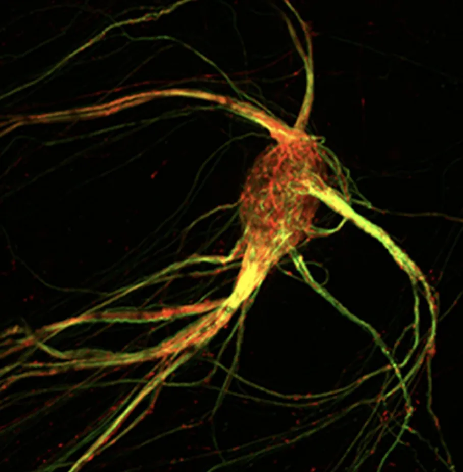 Labeled in red and green in this photo illustration are axons of sensory cells in a single glomerulus within a mouse brain’s olfactory bulb. (Lomvardas Lab, Columbia’s Zuckerman Institute)
